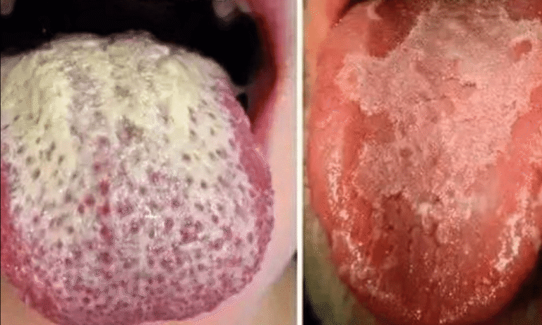 Descubre los secretos de tu salud a través de tu lengua