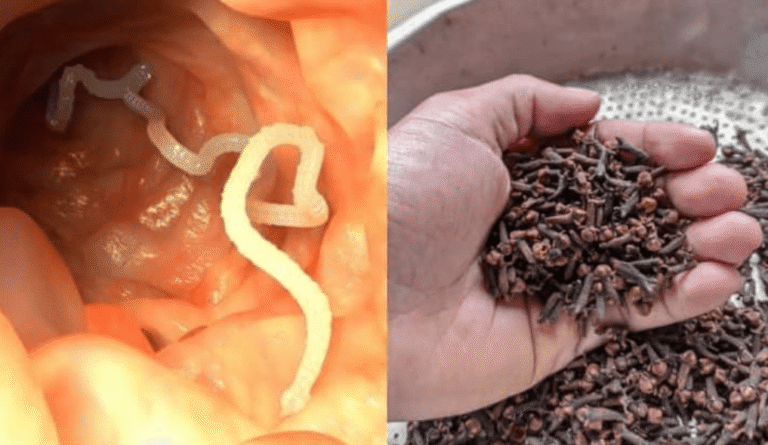 Secreto Natural para Limpiar el Colon y Perder Peso: Linaza y Clavo Revelados