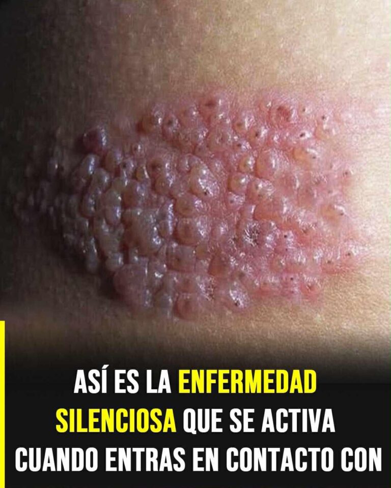 ¡Alerta! Descubre el secreto de esta enfermedad sigilosa que sorprende sin previo aviso.