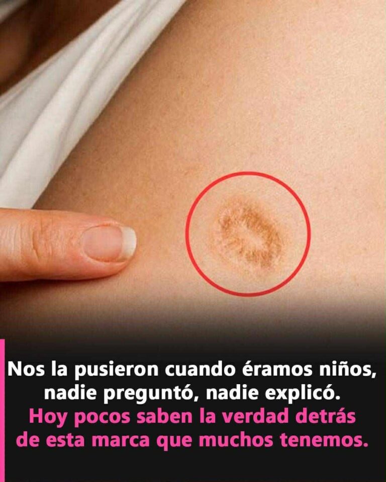 Descifrando los Misterios de las Marcas en tu Piel: Revelaciones Sorprendentes