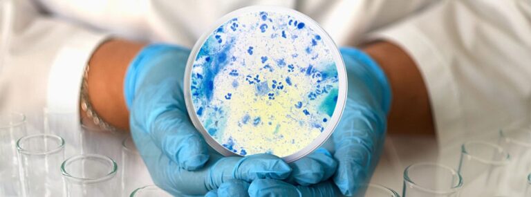 Descubre todo sobre la infección por Trichinella