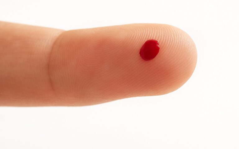 Desvelando el Alzheimer con una simple gota sanguínea