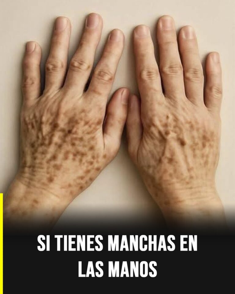 Secretos que tus manos revelan sobre tu salud