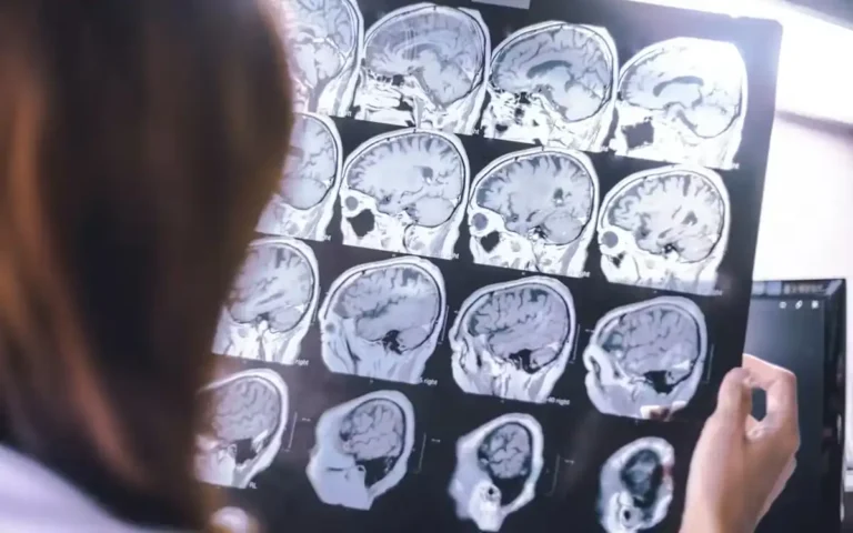 Trágico desenlace: Joven de 24 años con demencia fallece inesperadamente.