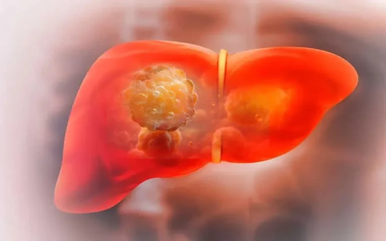 Descubrimiento: Cannabis mejora metabolismo y revierte hígado graso.